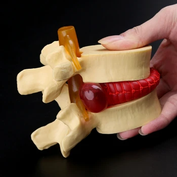 Felnőtt ember Anatómiai Gerinc Ágyéki porckorongsérv Modell Orvosi Tanítás, Tanulás Támogatás Anatómia Instrume Csontváz Eszközök DIY